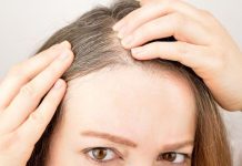 Why Hair Fall Isn’t Always About Genetics
